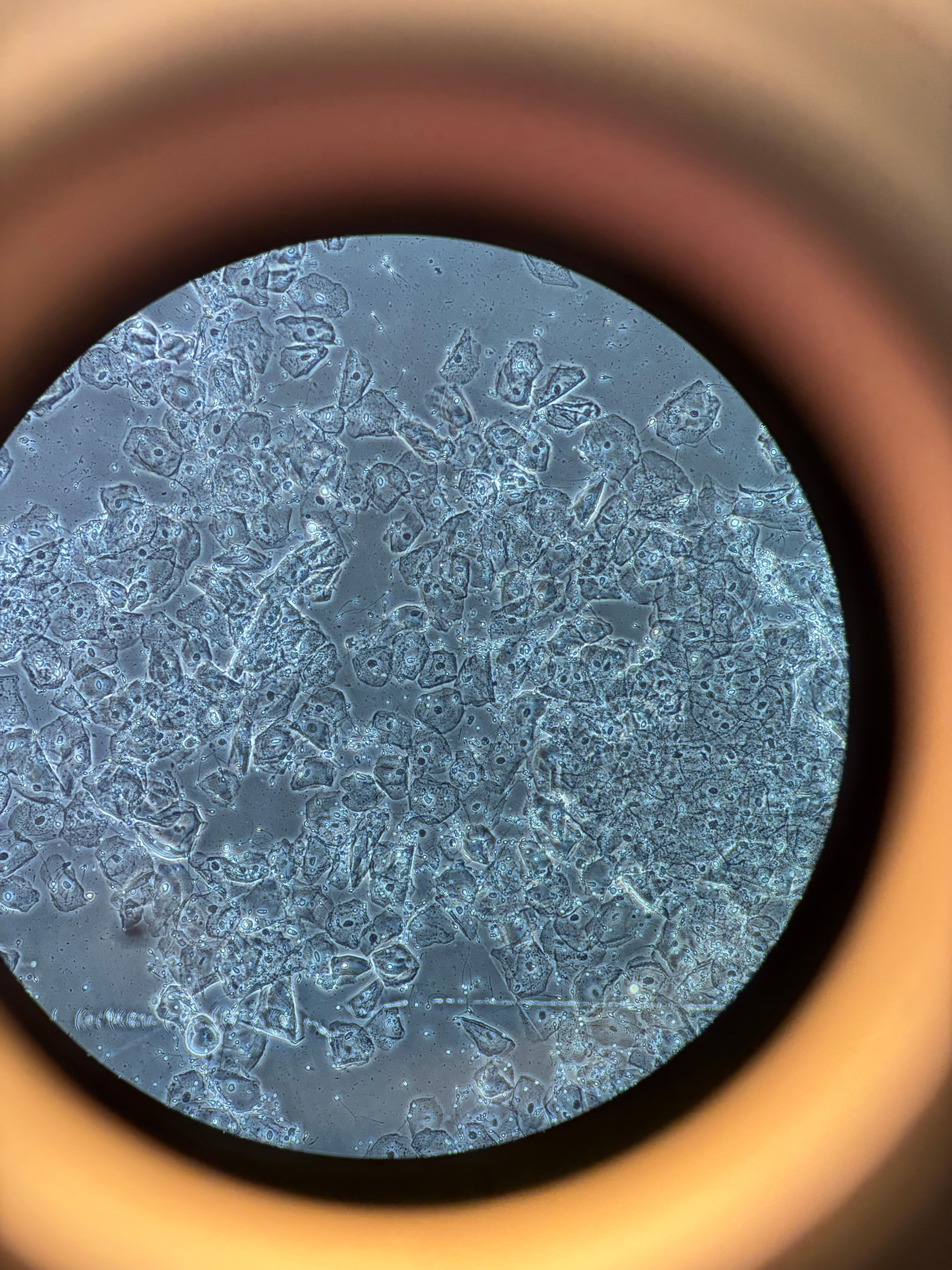 Microscopy of epithelial cells in a sperm sample
