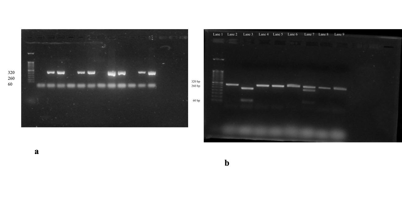Agarose gel electrophoresis of purified DNA digested with a restriction enzyme for TAS2R38